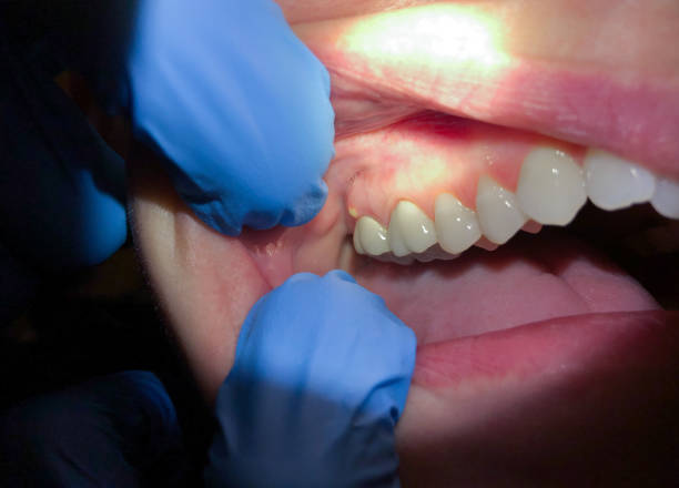 Best After-Hours Dental Trauma Care in Canby, MN